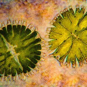 Micrasterias algae