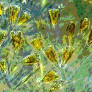 Gomphonema Algae